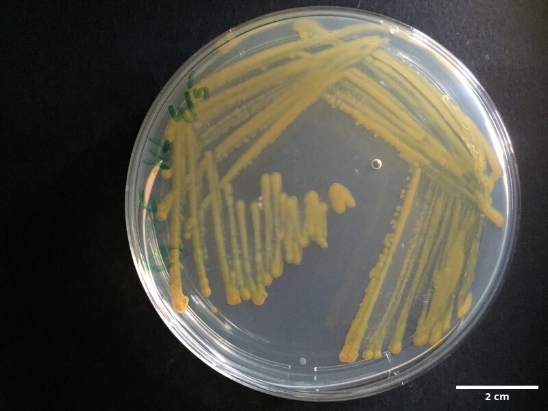Tenacibaculum_soleae_CCMAR-S_PG65